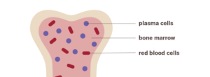 An infographic showing a close-up of the inside of a bone, including plasma cells, bone marrow, and red blood cells